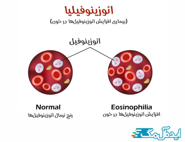 افزایش eos در آزمایش خون