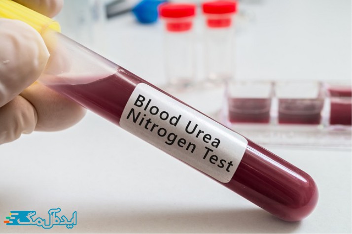 تفسیر نتایج اوره در آزمایش خون