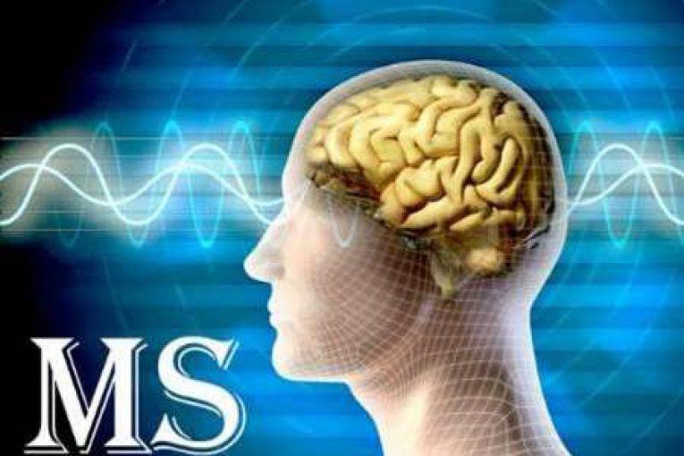 علائم و نشانه های ام اس