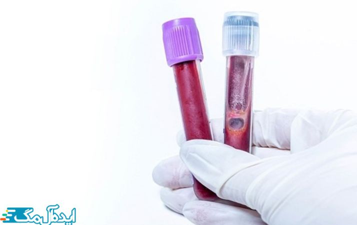 آزمایش خون hCG