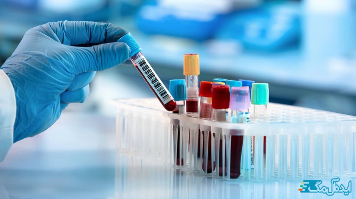 آزمایش خون IGRA در چه زمانی تجویز می‌شود؟