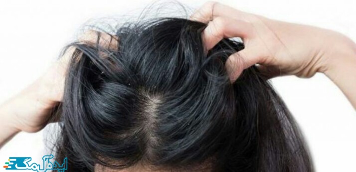 استرس می تواند بر سلامتی موهای شما تاثیر گذار باشد