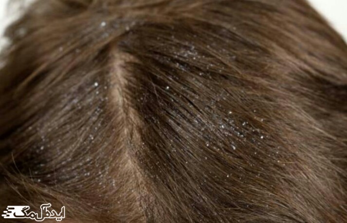 دانه شنبلیله می تواند بر روی سلامت موهای شما تاثیر گذار باشد