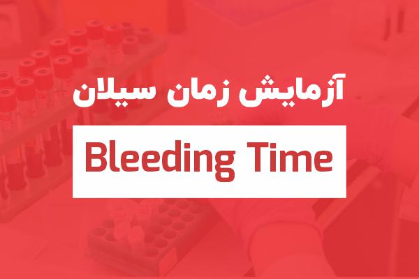 آزمایش زمان سیلان یا bleeding time