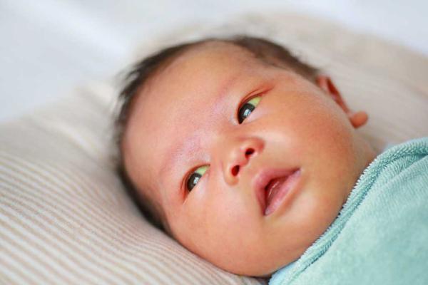زردی نوزاد چیست و چگونه درمان می‌شود؟