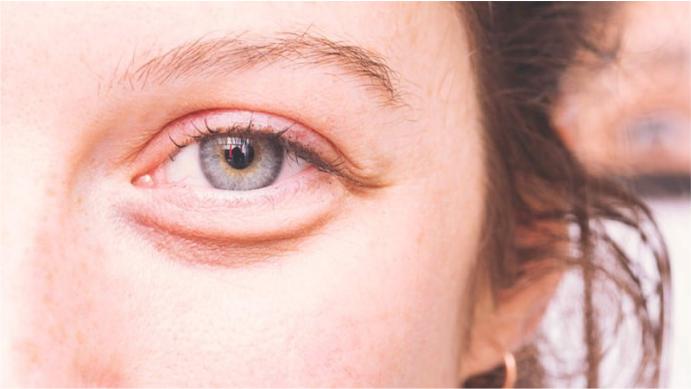 درمان ضعیفی چشم در خانه 