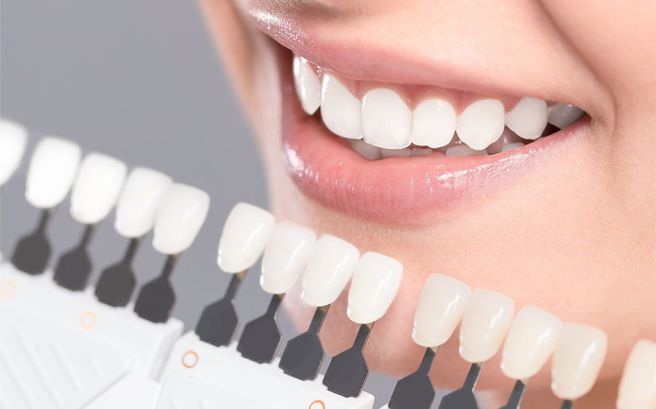 انواع کامپوزیت دندان کدامند ؟