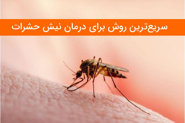 سریع ترین روش ها برای درمان نیش حشرات