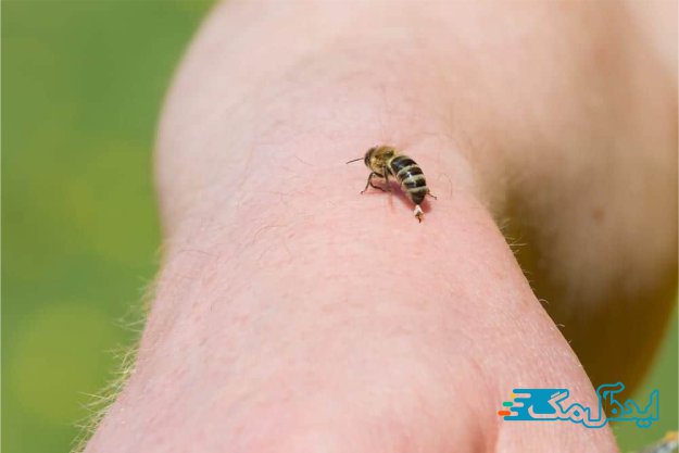 درمان نیش زنبور زرد