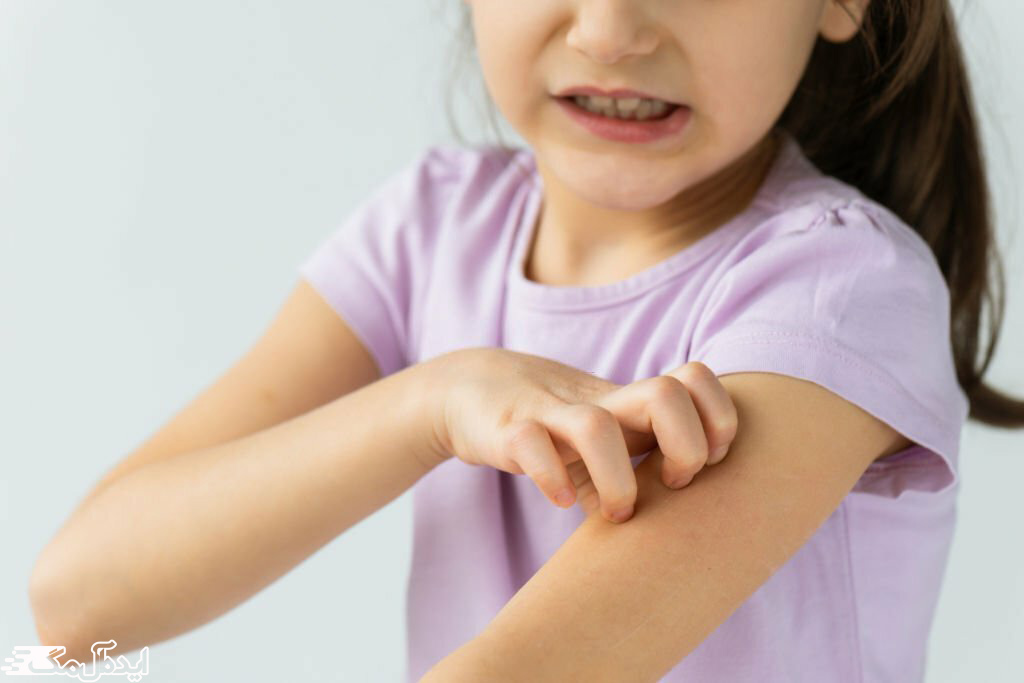 یک دختر بچه به خاراندن بازوی خود مشغول است