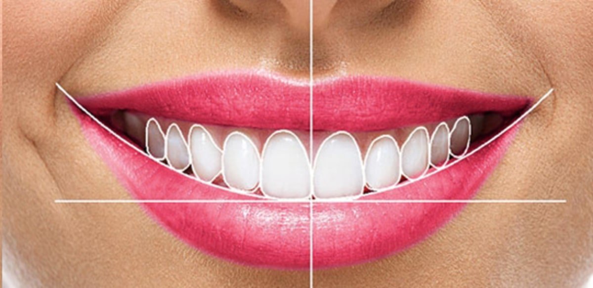 طراحی لبخند با دندانپزشکی دیجیتال