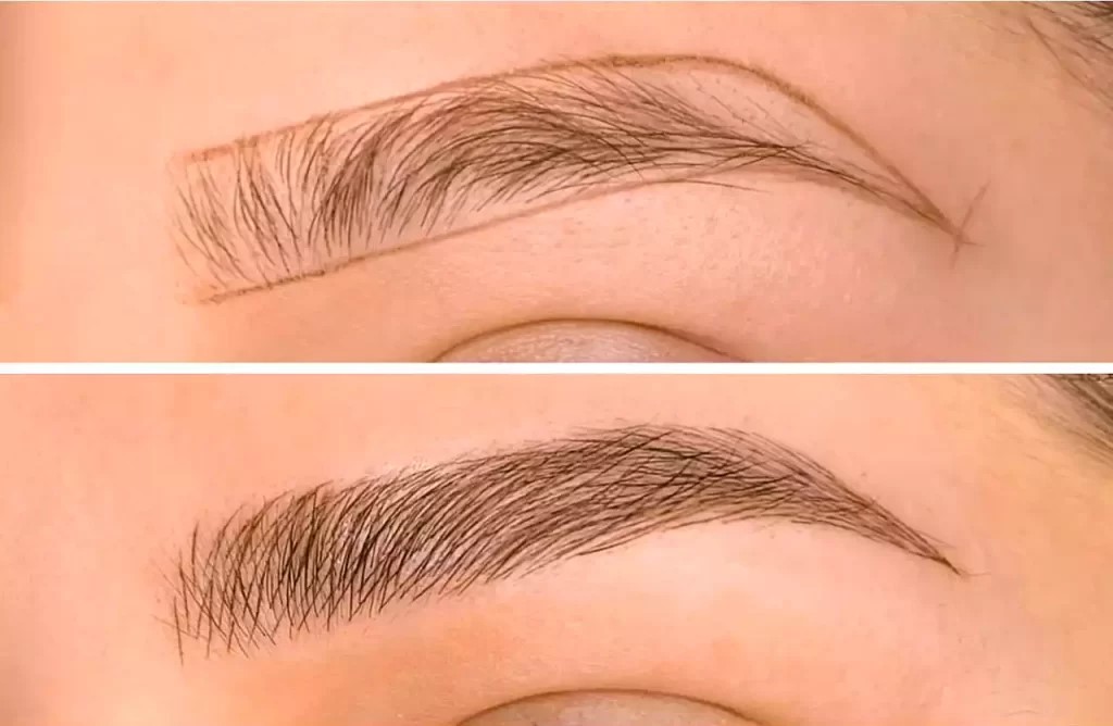 اجرای فوق طبیعی میکروبلیدینگ