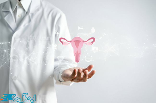 یک پزشک که تصویر تخمدانها و رحم در بالای دست او دیده میشود
