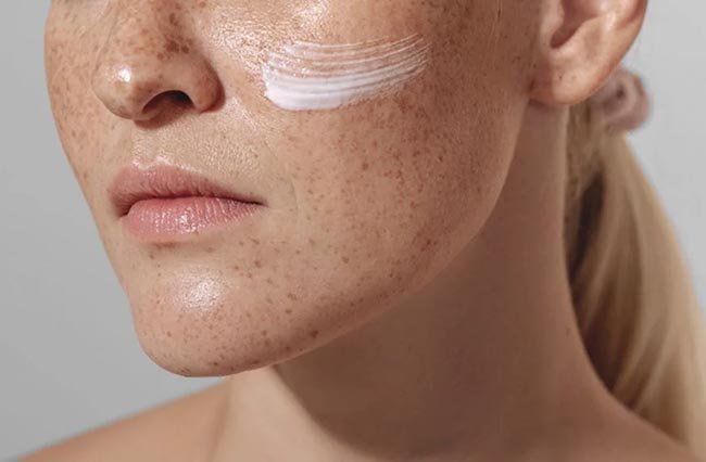 راهکارهای مراقبت از پوست در برابر جوش و آکنه در بهار