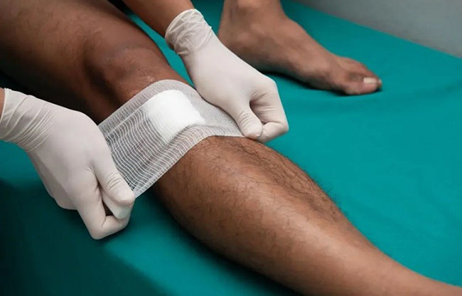 یک نفر مشغول پانسمان کردن پای آسیب دیده خود است