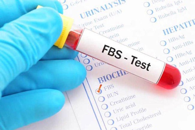 نمونه تست FBS خون
