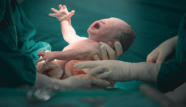 نوزاد تازه به دنیا آمده، در دست پزشک است و در حال گریه است