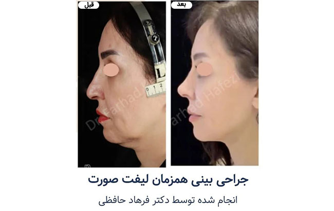 نمونه کار دکتر فرهاد حافظی