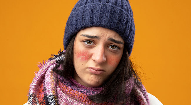 لکه های قرمز پروانه ای شکل روی گونه‌ها در اثر بیماری لوپوس ایجاد می شوند