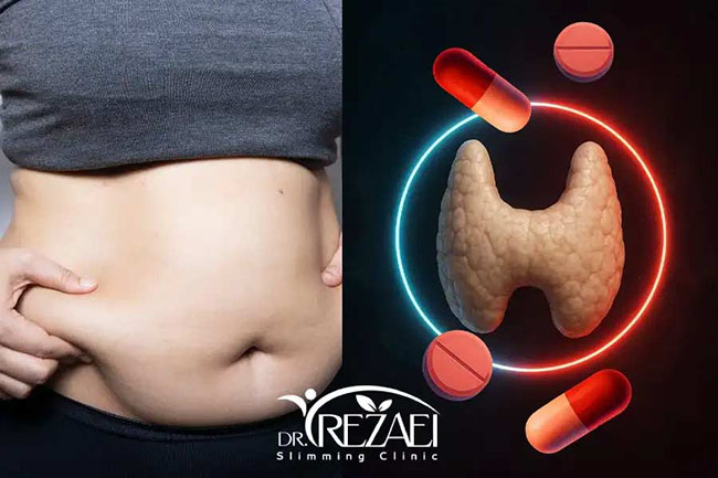 مدیریت وزن در بیماران مبتلا به کم کاری تیروئید